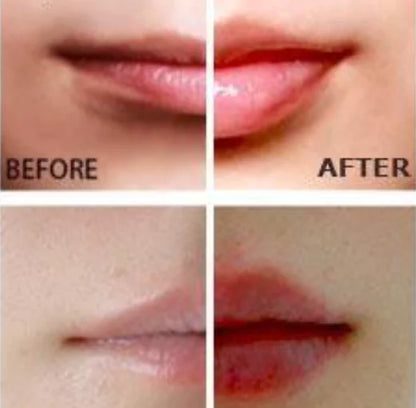 💄✨ Miracle Lip Plumper – Labios Más Voluminosos al Instante